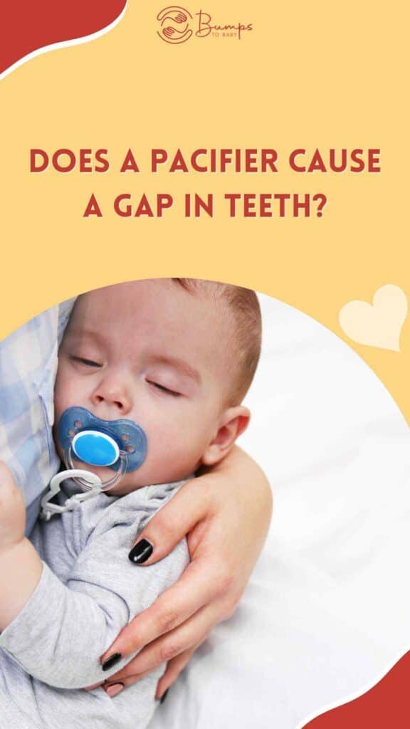 Does A Pacifier Cause A Gap In Teeth
